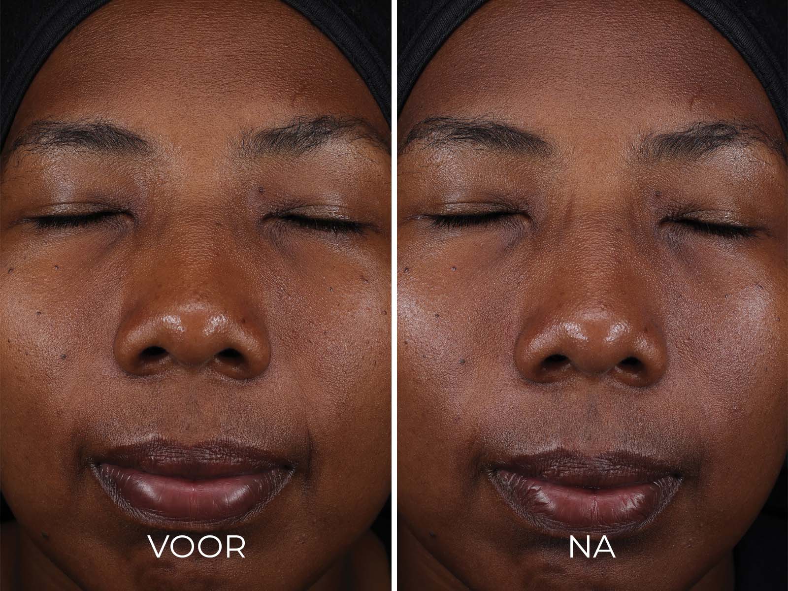 Productafbeelding 4
