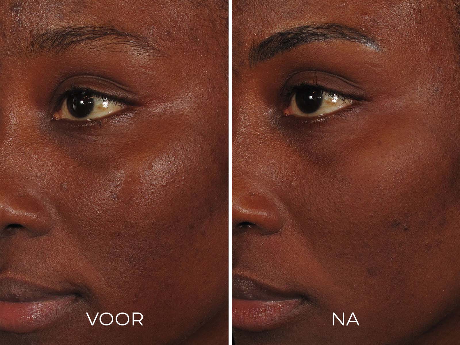 Productafbeelding 4